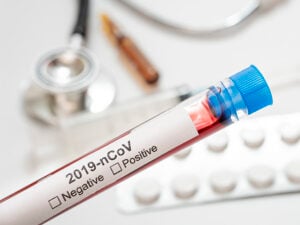 Rastreo de casos COVID-19:  De la ineficiencia de Salud al avance en cinco municipios